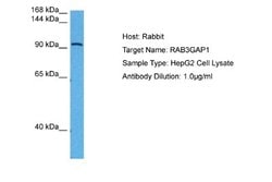 RAB3GAP1 Rabbit anti-Human, Polyclonal, Novus Biologicals 0.1ml; Unconjugated:Antibodies,
